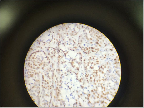 product-image-AAA31048_IHC2.jpg