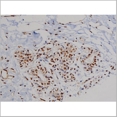 product-image-AAA31050_IHC4.jpg
