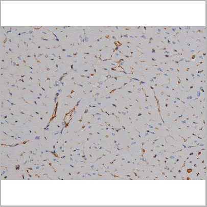 product-image-AAA31050_IHC5.jpg