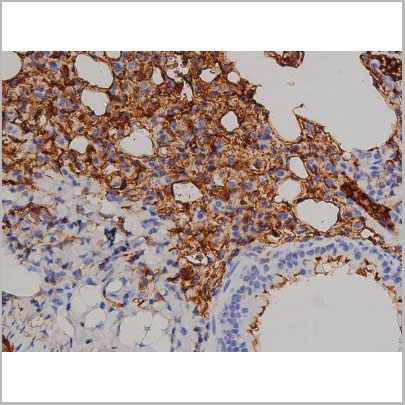 product-image-AAA31050_IHC6.jpg