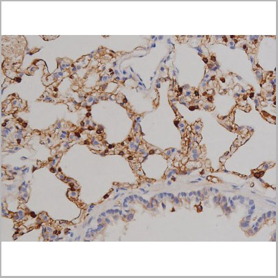 product-image-AAA31050_IHC9.jpg