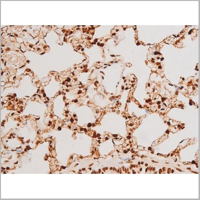 product-image-AAA31051_IHC12.jpg