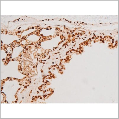 product-image-AAA31051_IHC13.jpg