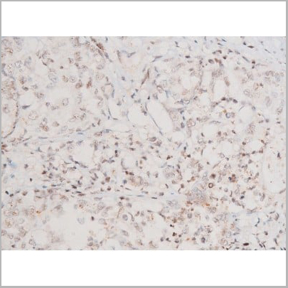product-image-AAA31051_IHC16.jpg