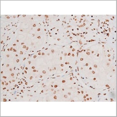 product-image-AAA31051_IHC17.jpg
