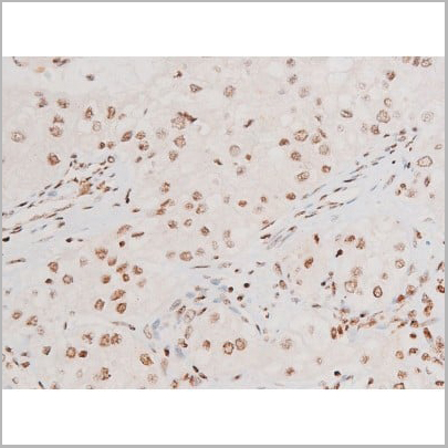 product-image-AAA31051_IHC18.jpg