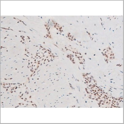 product-image-AAA31051_IHC19.jpg