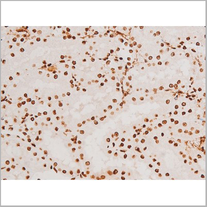 product-image-AAA31051_IHC2.jpg