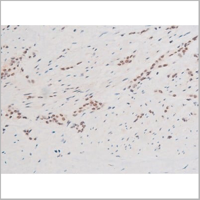 product-image-AAA31051_IHC20.jpg