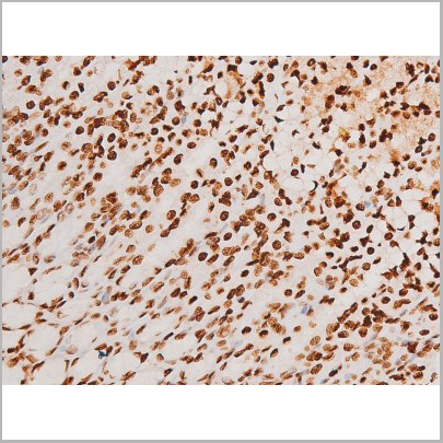 product-image-AAA31051_IHC3.jpg