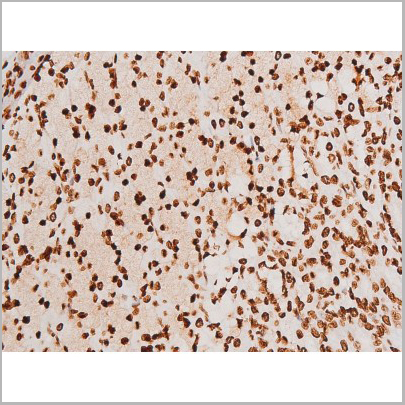 product-image-AAA31051_IHC4.jpg