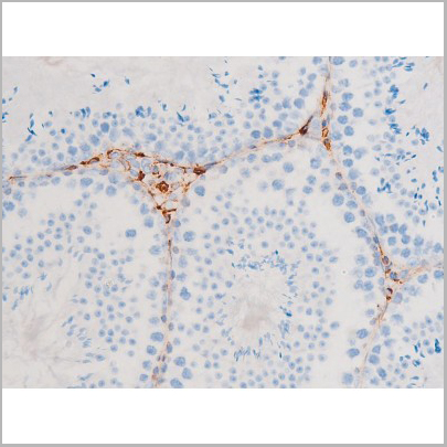product-image-AAA31051_IHC7.jpg