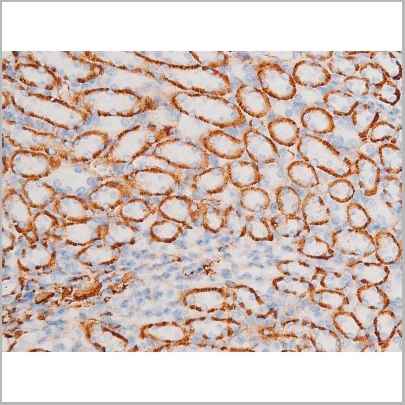 product-image-AAA31051_IHC8.jpg