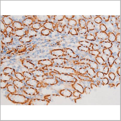 product-image-AAA31051_IHC9.jpg