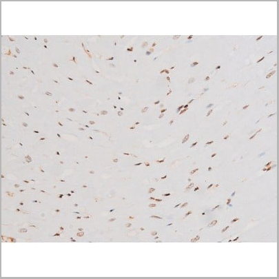 product-image-AAA31052_IHC14.jpg