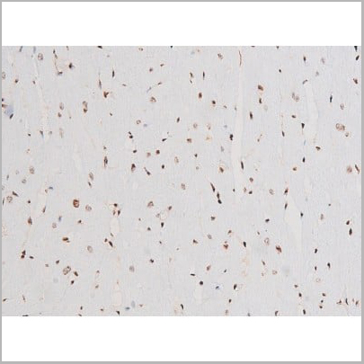 product-image-AAA31052_IHC15.jpg
