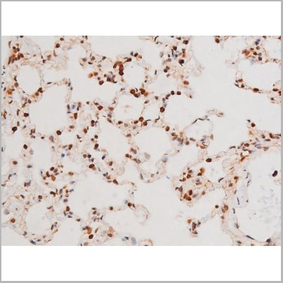 product-image-AAA31052_IHC16.jpg