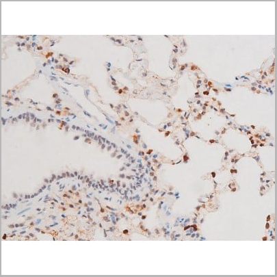 product-image-AAA31052_IHC17.jpg