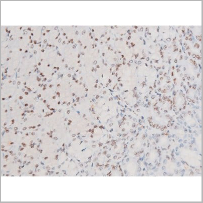 product-image-AAA31052_IHC18.jpg