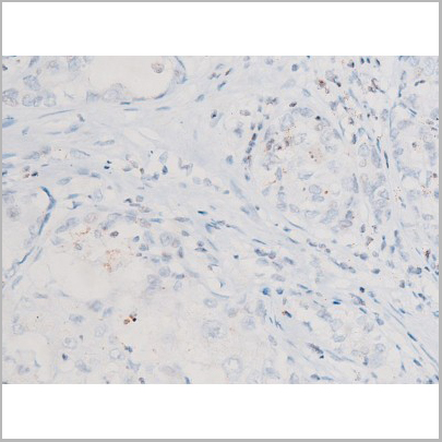 product-image-AAA31052_IHC2.jpg