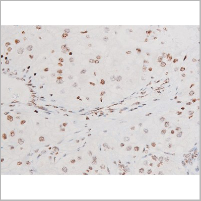 product-image-AAA31052_IHC3.jpg