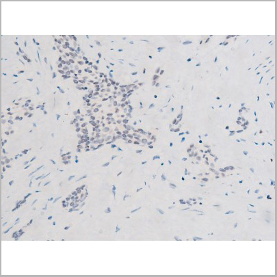 product-image-AAA31052_IHC6.jpg