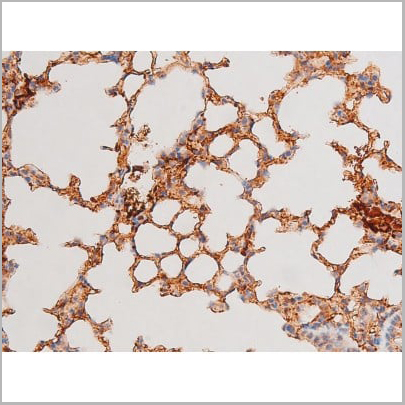 product-image-AAA31053_IHC11.jpg