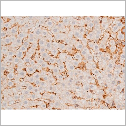 product-image-AAA31053_IHC12.jpg