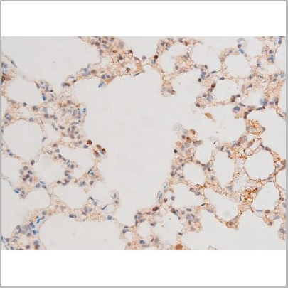 product-image-AAA31053_IHC13.jpg
