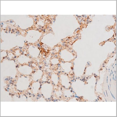 product-image-AAA31053_IHC14.jpg