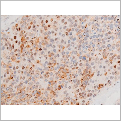 product-image-AAA31053_IHC2.jpg