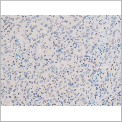 product-image-AAA31053_IHC3.jpg