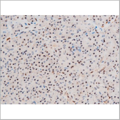 product-image-AAA31053_IHC4.jpg