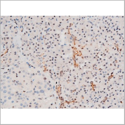 product-image-AAA31053_IHC5.jpg