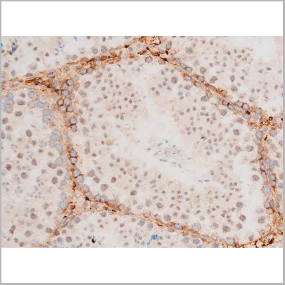product-image-AAA31053_IHC6.jpg