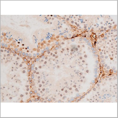 product-image-AAA31053_IHC7.jpg