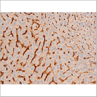 product-image-AAA31053_IHC8.jpg