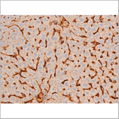 product-image-AAA31053_IHC9.jpg