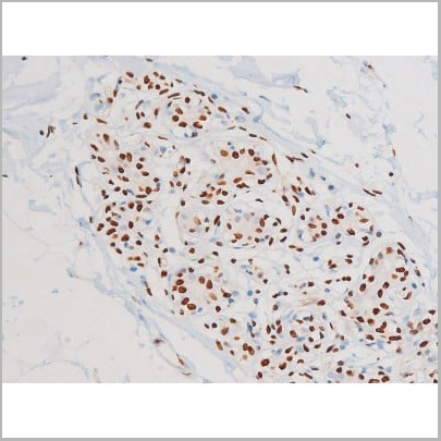 product-image-AAA31054_IHC14.jpg