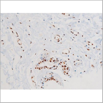 product-image-AAA31054_IHC15.jpg