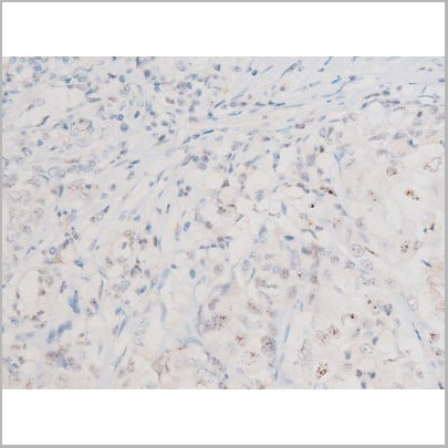 product-image-AAA31054_IHC16.jpg