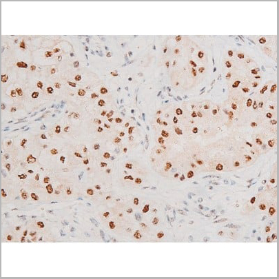 product-image-AAA31054_IHC17.jpg