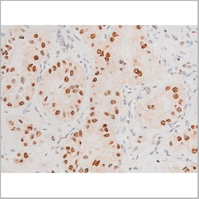 product-image-AAA31054_IHC18.jpg