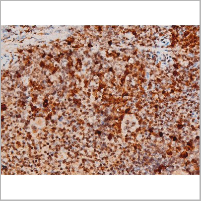 product-image-AAA31054_IHC2.jpg