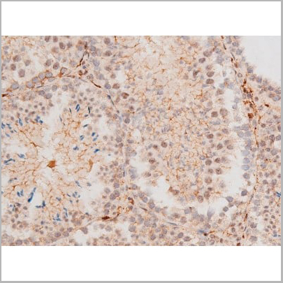 product-image-AAA31054_IHC20.jpg