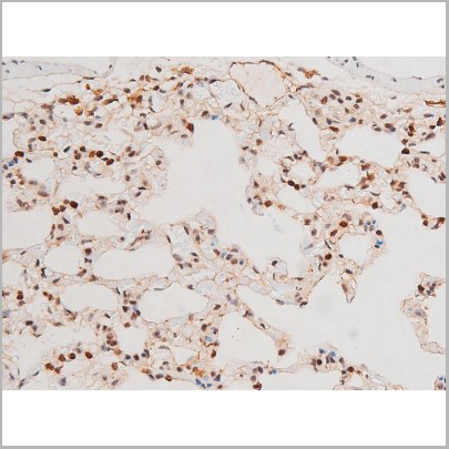product-image-AAA31054_IHC5.jpg