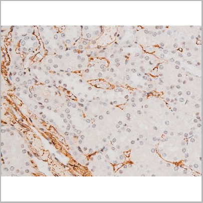 product-image-AAA31054_IHC6.jpg