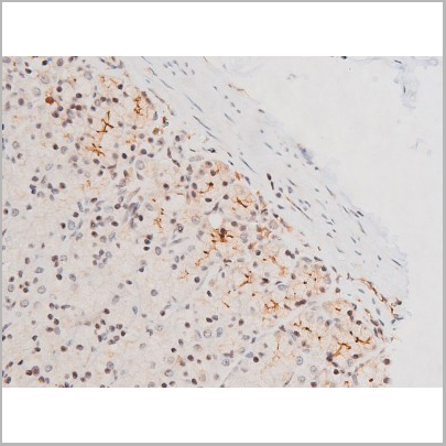 product-image-AAA31054_IHC8.jpg
