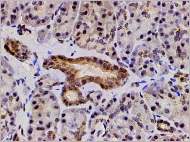 product-image-AAA31055_IHC12.jpg