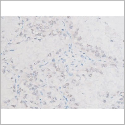 product-image-AAA31055_IHC16.jpg